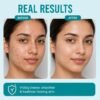 61zKaXpTb2L._SX522_ Face Wash for Hyperpigment, Dull skin with Vitamin B5, Deep Cleansing & Oil Control, 150 ml (1% Salicylic Acid Facewash)