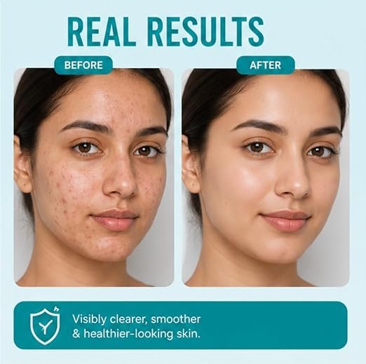 61zKaXpTb2L._SX522_ Face Wash for Hyperpigment, Dull skin with Vitamin B5, Deep Cleansing & Oil Control, 150 ml (1% Salicylic Acid Facewash)