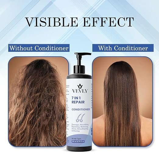 91+1lZ-+iZL._SX522_ Conditioner, Anti Hair Fall, Frizz-Free, Soothes Dry Scalp, Boosts Hair Growth, All Hair Types, 200 ml (7 in 1 Repair Conditioner)