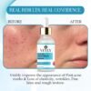 Alpha Arbutin 2% Face Serum for Dark Spot Care, Skin Texture, Brightening, Revitalizer, 30 ml for Men & Women