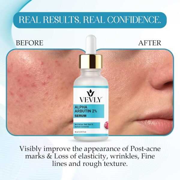 Alpha Arbutin 2% Face Serum for Dark Spot Care, Skin Texture, Brightening, Revitalizer, 30 ml for Men & Women