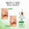 vevly niacinamide 10%-1 Niacinamide 10% Serum for Hyperpigmentation & Dull Skin, Reduces Blemishes & Acne Marks, Brightening Face Serum, 30ml