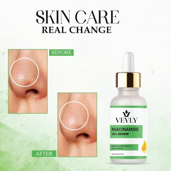 vevly niacinamide 10%-1 Niacinamide 10% Serum for Hyperpigmentation & Dull Skin, Reduces Blemishes & Acne Marks, Brightening Face Serum, 30ml