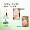 vevly niacinamide 10%-2 Niacinamide 10% Serum for Hyperpigmentation & Dull Skin, Reduces Blemishes & Acne Marks, Brightening Face Serum, 30ml